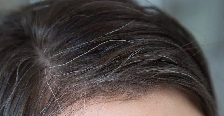 Can Gray Hair Be Reversed Causes and Treatment  GoodRx