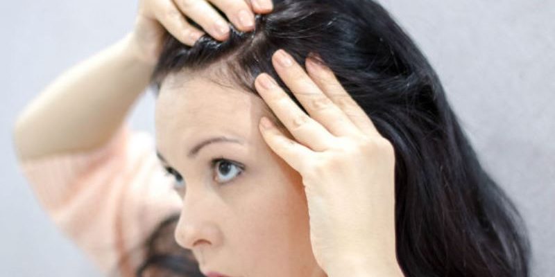 Premature Grey Hair in Teenagers - Causes and Remedies