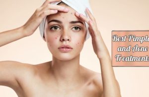 causes of acne and pimples on face